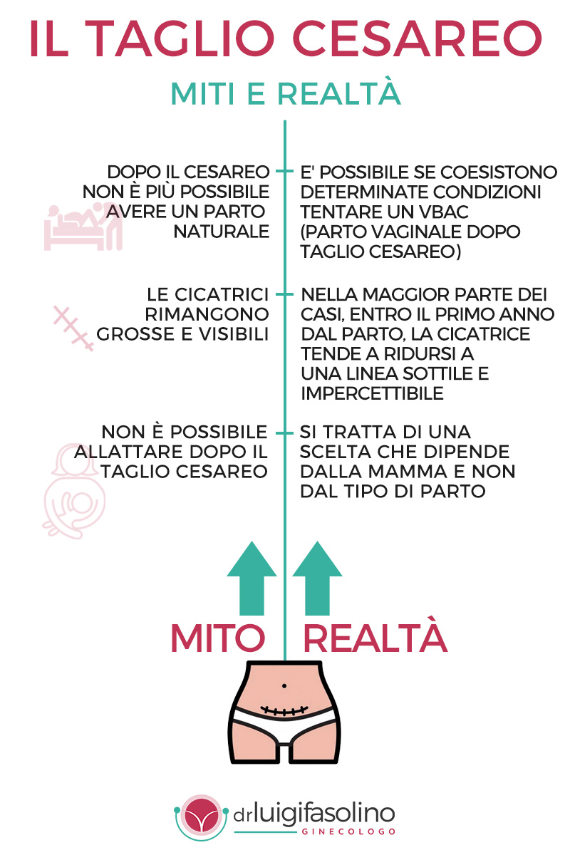 infografica il taglio cesareo