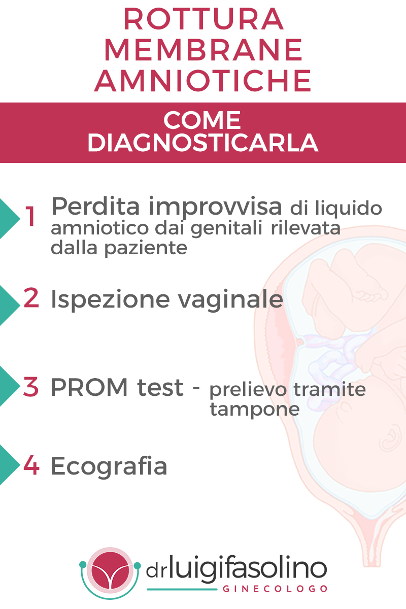 diagnosticare-gestire-rottura-membrane-amniotiche